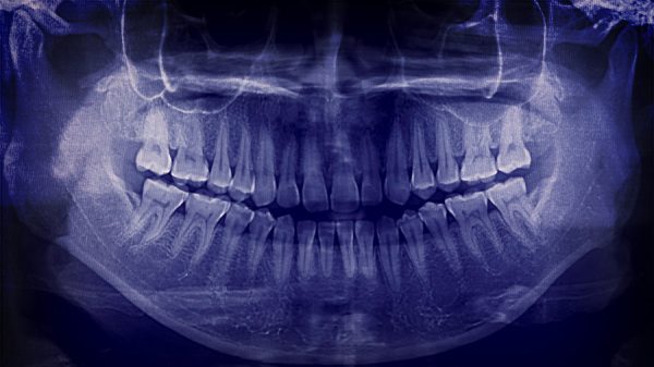 ortopedia-dento-facciale